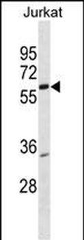PKNOX2 Antibody (Center)