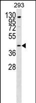 GPR172B Antibody (Center)