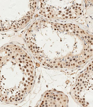 ALKBH5 Antibody (Center)