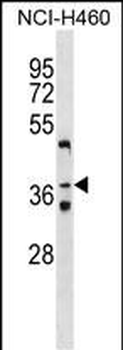 ZNF691 Antibody (Center)