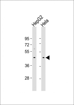 GIPC3 Antibody (C-term)