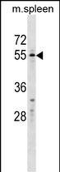WFIKKN2 Antibody (C-term)