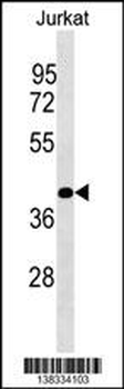 PLCXD1 Antibody (Center)