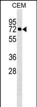 KLHL28 Antibody (C-term)