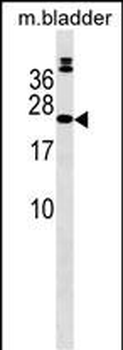 COMMD10 Antibody (Center)