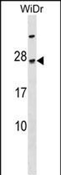 TGIF2LY Antibody (N-term)