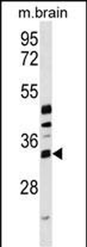 METTL6 Antibody (Center)