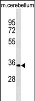 UCK1 Antibody (C-term)