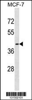 OR56B1 Antibody (N-term)