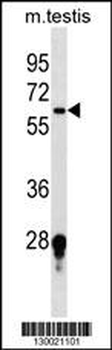 FUT11 Antibody (Center)