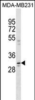 CCDC28A Antibody (N-term)