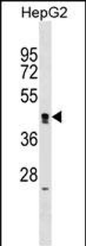 ZNF556 Antibody (N-term)