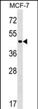 ZBTB12 Antibody (C-term)