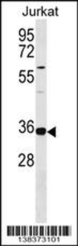 TRNAU1AP Antibody (Center)