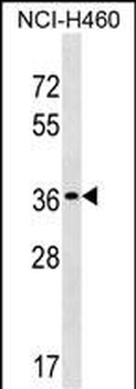 TP53TG5 Antibody (Center)