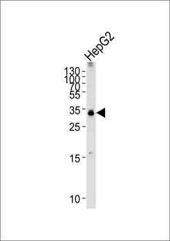 TCEAL2 Antibody (N-term)