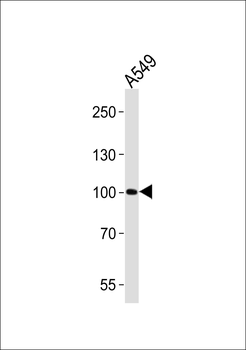 ZNF287 Antibody (N-term)