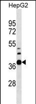RPUSD1 Antibody (Center)