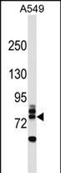 RNF157 Antibody (N-term)