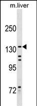KIF15 Antibody (Center)