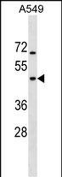 GTPBP5 Antibody (N-term)