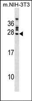 FGFR1OP2 Antibody (Center)