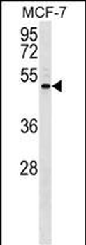 ENPP5 Antibody (C-term)