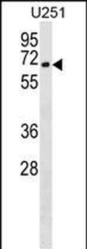 CORO2B Antibody (N-term)