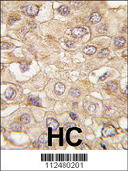 DRAM Antibody (C-term)