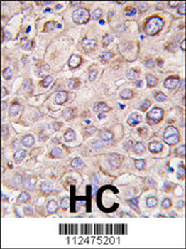 DRAM Antibody (N-term)