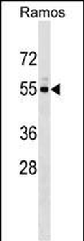 UNC5CL Antibody (Center)