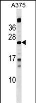 MBD3L1 Antibody (C-term)
