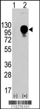 LAMP2 Antibody (Center)