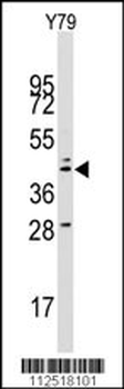 LAMP2 Antibody (C-term)