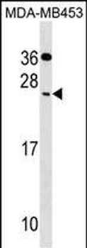 CIDEC Antibody (Center)