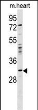 OTP Antibody (Center)