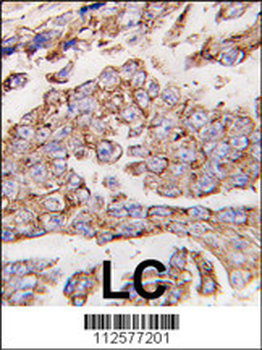 LAMP1 Antibody (N-term)