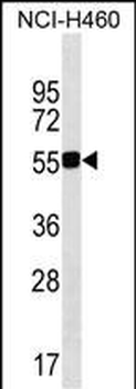 QRSL1 Antibody (N-term)