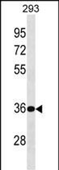 BPHL Antibody (Center)