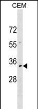 NKX2-6 Antibody (N-term)