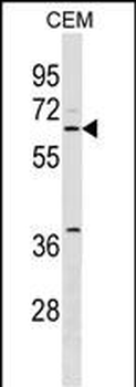 SPS2L Antibody (N-term)