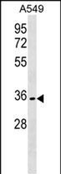 OR51B6 Antibody (C-term)
