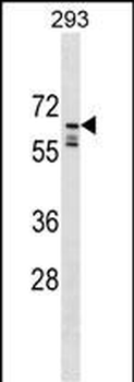 PPIL2 Antibody (C-term)