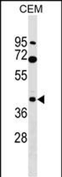 CACNG3 Antibody (N-term)