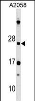 DRAP1 Antibody (N-term)
