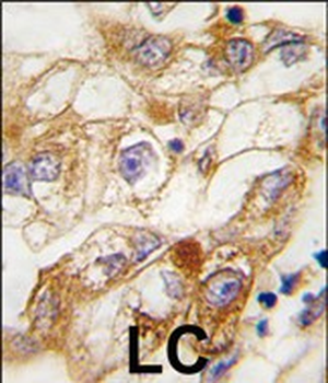 RGS19 Antibody (S24)
