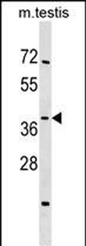 SIRT4 Antibody (N-term)