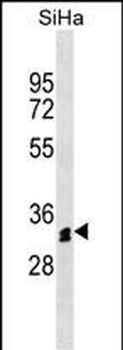 OR51M1 Antibody (N-term)