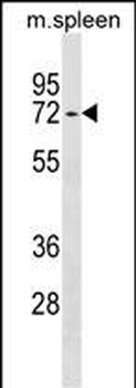 ENTPD4 Antibody (N-term)