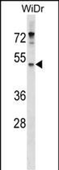 ENPP4 Antibody (Center)